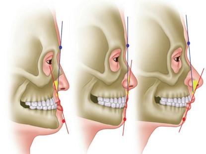 les maladies des maxillaires, de la face, de la bouche, et des dents