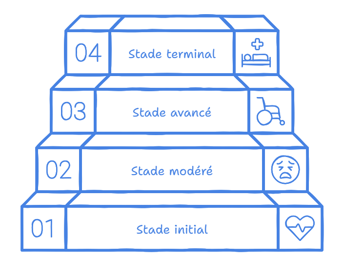 Progression des stades de l'insuffisance cardiaque