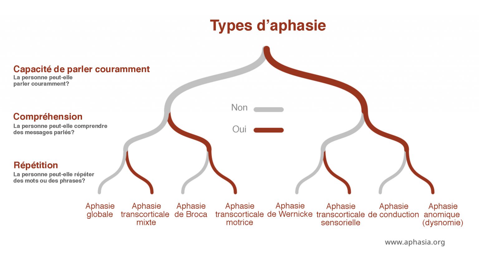 Les types d’aphasie